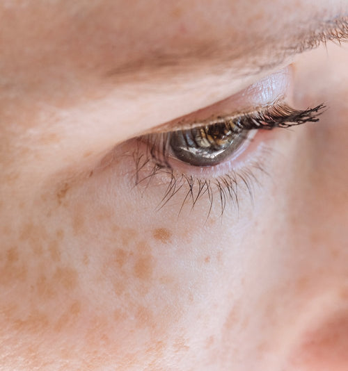 Counteract & reduce your pigment spots