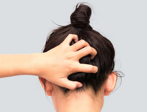 Our customers tell us about their Scalp discomfort