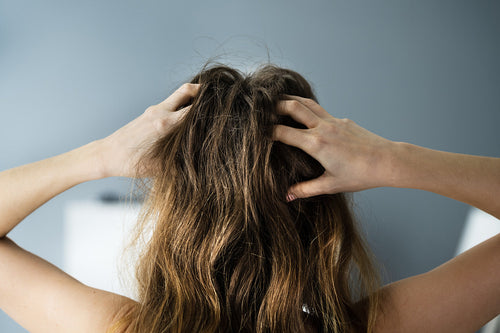 Are you struggling with Scalp discomfort and have tried everything without results?