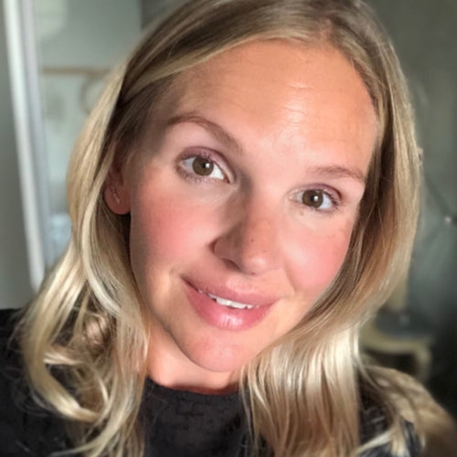 Annas berättelse om hyperpigmentering