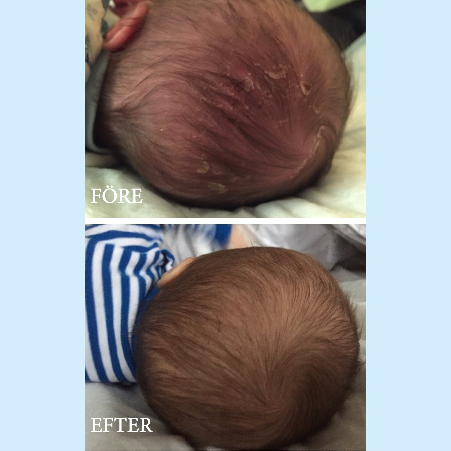 Våra kunder berättar om deras bebisar med skorv