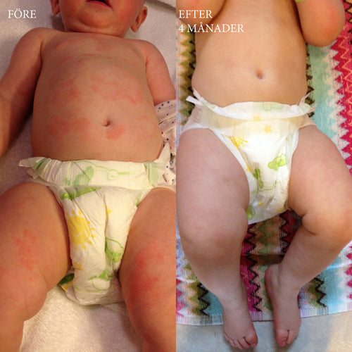 Tovas mamma berättar