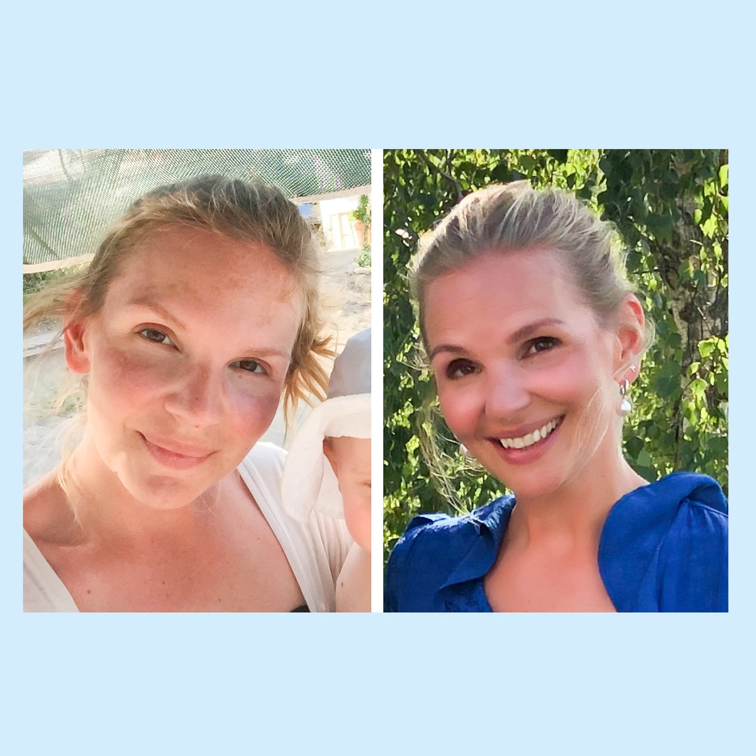 Mindre fläckar och mer självkänsla