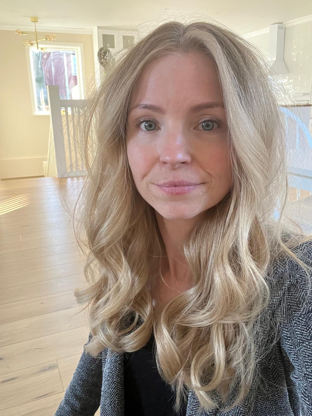 Therese berättar hur hon fann Q for Skin