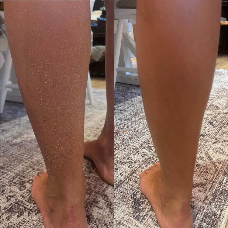Q for Skin