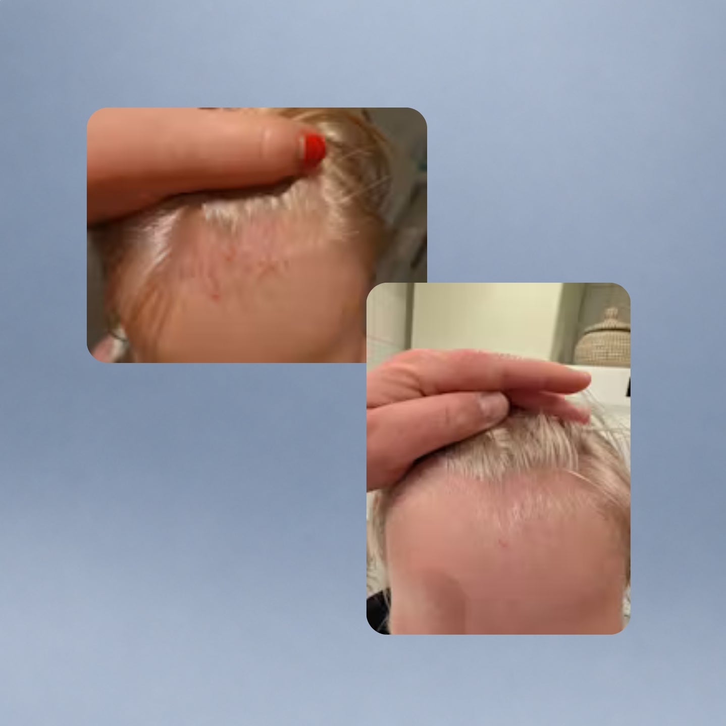 Q for Skin