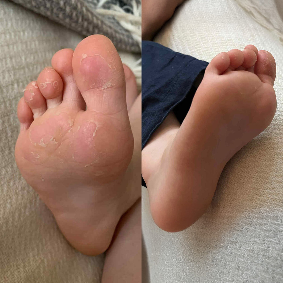 Q for Skin
