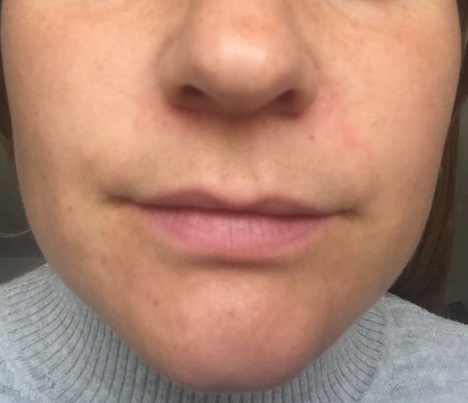 Efter